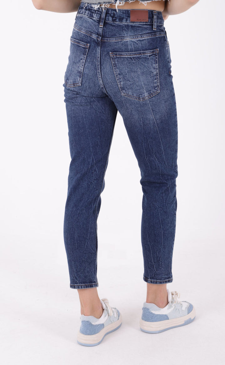XLJ Destroy Lazer Detaylı Mom Fit Kot Pantolon - Albany